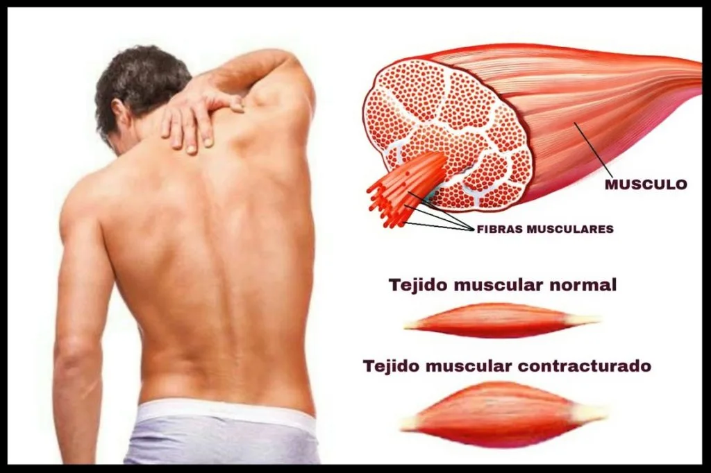musculo fibras y tejidos